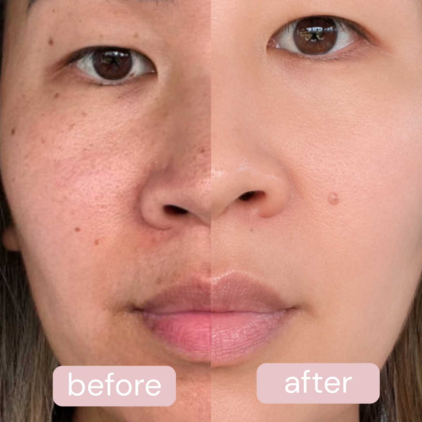 60-Second Deep Cleanse Device